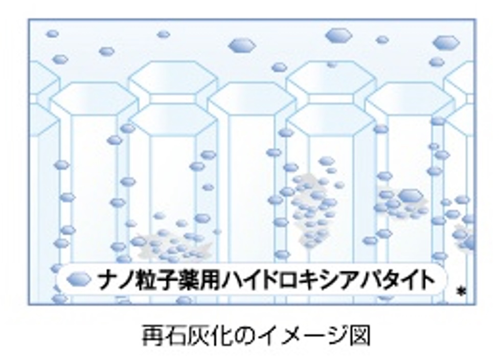 ハイドロキシアパタイトによる修復
