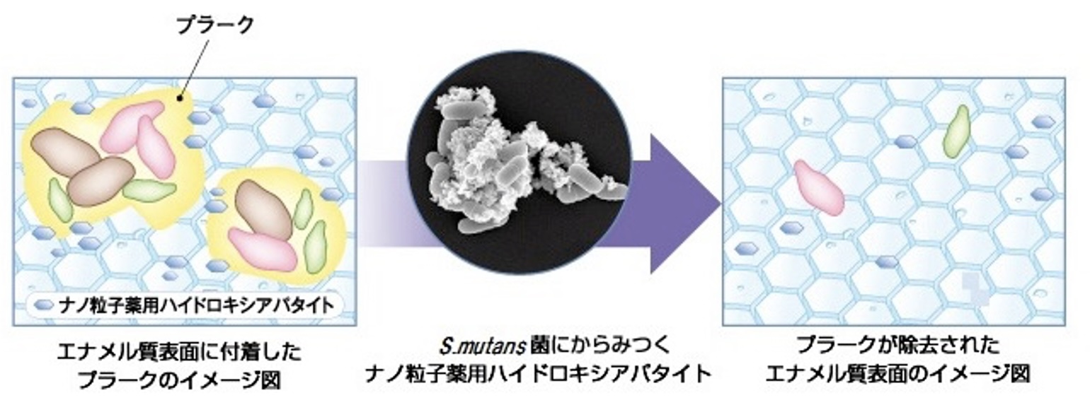 プラーク除去メカニズム