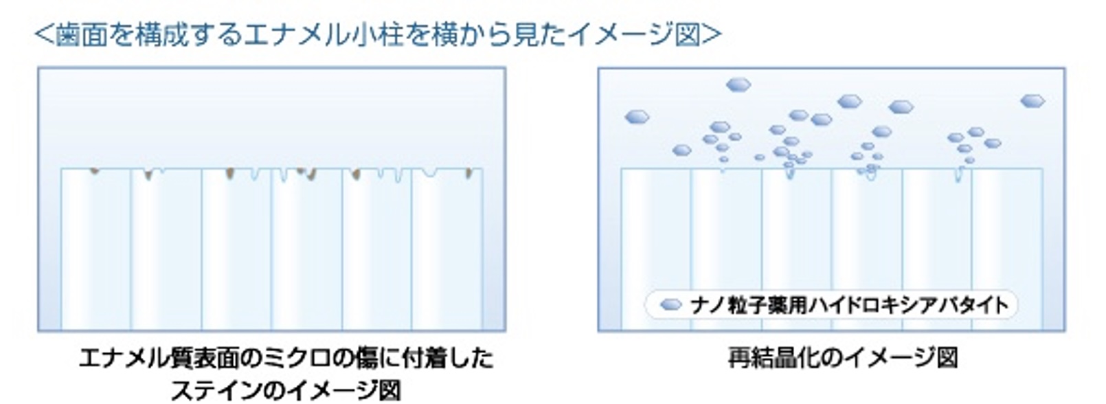 傷に付着したステイン