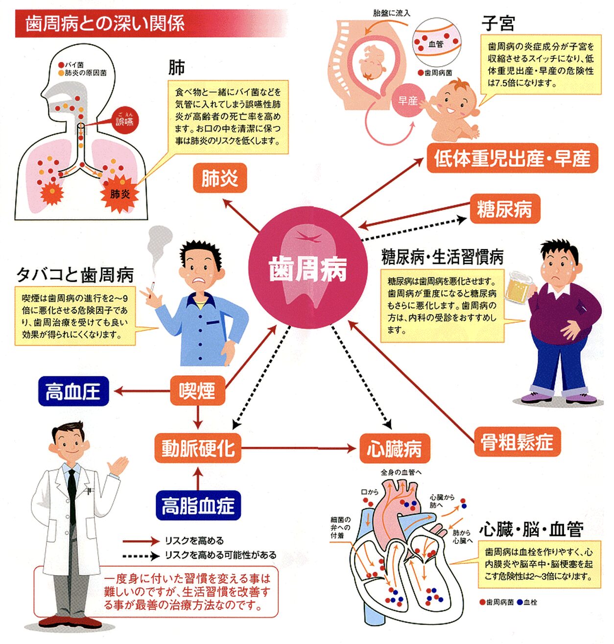 歯周病は糖尿病・高血圧と相互に悪くなり脳梗塞、心筋梗塞のリスクが高くなる