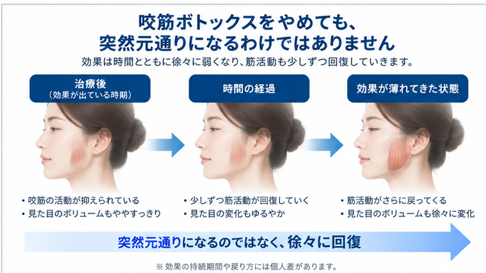 ボツリヌス治療の効果期間のタイムライン